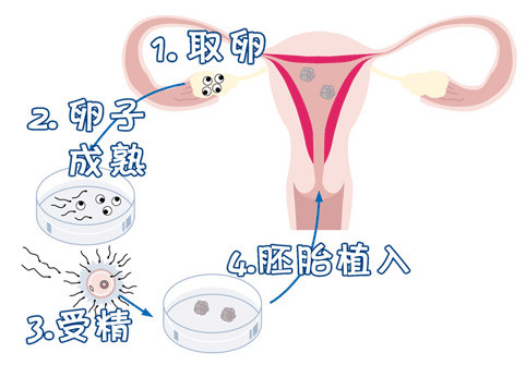 代生男孩机构